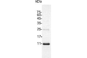 SDS-PAGE (SDS) image for Interleukin 4 (IL4) (Active) protein (His tag) (ABIN7884504)