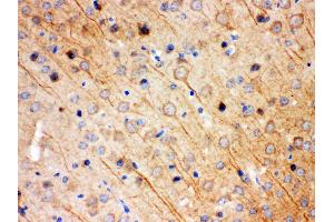 Anti- KCNIP2 Picoband antibody,IHC(P) IHC(P): Mouse Brain Tissue (KCNIP2 抗体  (N-Term))