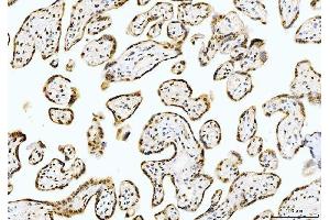 IHC analysis of Cyclophilin E/PPIE using anti-Cyclophilin E/PPIE antibody (ABIN7599242). (PPIE 抗体  (AA 1-301))