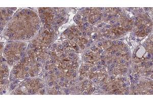 Immunohistochemistry (IHC) image for anti-Olfactory Receptor, Family 2, Subfamily W, Member 1 (OR2W1) (C-Term) antibody (ABIN6259249)