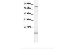 Image no. 1 for anti-PiggyBac Transposable Element Derived 3 (PGBD3) (AA 52-101) antibody (ABIN202794) (PGBD3 抗体  (AA 52-101))