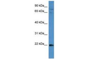 Image no. 1 for anti-Mitogen-Activated Protein Kinase Kinase Kinase 15 (MAP3K15) (AA 1201-1250) antibody (ABIN6743478) (MAP3K15 抗体  (AA 1201-1250))