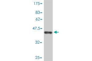 Western Blot detection against Immunogen (43. (BTF3 抗体  (AA 1-162))
