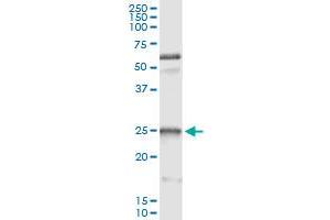 Immunoprecipitation (IP) image for anti-Heat Shock 27kDa Protein 1 (HSPB1) (AA 96-205) antibody (ABIN516740)