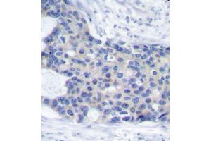 Immunohistochemistry (IHC) image for anti-zeta-Chain (TCR) Associated Protein Kinase 70kDa (ZAP70) (pTyr493) antibody (ABIN3020535) (ZAP70 抗体  (pTyr493))