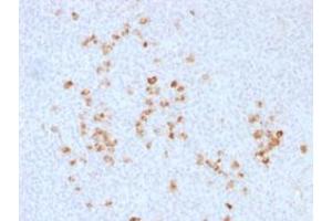 Immunohistochemical staining (Formalin-fixed paraffin-embedded sections) of human tonsil with IgG (Heavy Chain) polyclonal antibody . (兔 anti-人 Immunoglobulin Heavy Constant gamma 1 (G1m Marker) (IGHG1) (Heavy Chain) Antibody)