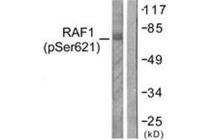 Western blot analysis of extracts from HeLa cells treated with UV 5', using C-RAF (Phospho-Ser621) Antibody. (RAF1 抗体  (pTyr621))