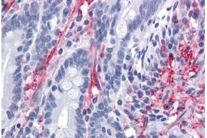 Human Small Intestine: Formalin-Fixed, Paraffin-Embedded (FFPE) (MYOC 抗体  (AA 36-135))