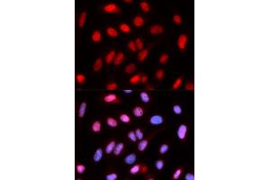 Immunofluorescence analysis of U2OS cells using RFC4 antibody. (RFC4 抗体)