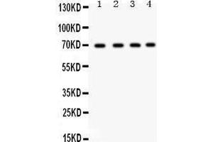 Western Blotting (WB) image for anti-X-Ray Repair Complementing Defective Repair in Chinese Hamster Cells 6 (XRCC6) (AA 464-496), (C-Term) antibody (ABIN3043965) (XRCC6 抗体  (C-Term))