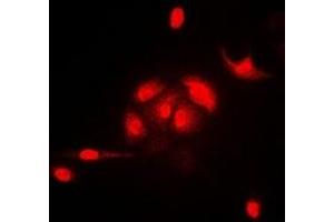 Immunofluorescent analysis of HEMK2 staining in A549 cells. (N6AMT1 抗体)