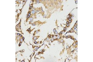 Immunohistochemistry (IHC) image for anti-Low Density Lipoprotein Receptor-Related Protein Associated Protein 1 (LRPAP1) antibody (ABIN1680715) (LRPAP1 抗体)