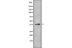 Western blot analysis of CGRRF1 using K562 whole cell lysates (CGR19 抗体  (Internal Region))