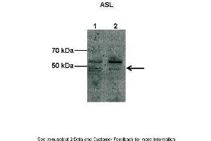 Lanes:  Lane1: 10 ug COS-7 cell lysate Lane2: 10 ug bovine aortic endothelial cell lysate Primary Antibody Dilution:  1:1000 Secondary Antibody:  Anti-rabbit HRP Secondary Antibody Dilution:  1:2000 Gene Name:  Asl Submitted by:  Shawn Elms. (ASL 抗体  (C-Term))
