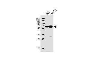 Western Blot at 1:1000 dilution Lane 1: Hela whole cell lysate Lane 2: HepG2 whole cell lysate Lysates/proteins at 20 ug per lane. (UTP6 抗体  (N-Term))