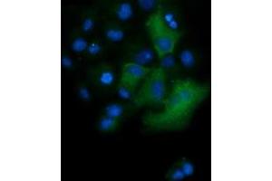 Image no. 3 for anti-Tripartite Motif Containing 38 (TRIM38) (AA 1-265) antibody (ABIN1490682) (TRIM38 抗体  (AA 1-265))