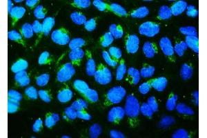 IF analysis of MFN1 using anti-MFN1 antibody (ABIN7603129).