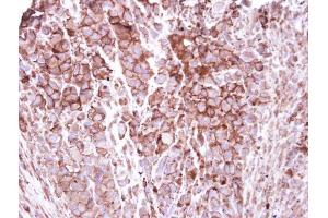 IHC-P Image Immunohistochemical analysis of paraffin-embedded H661 xenograft, using ZO-1, antibody at 1:250 dilution. (TJP1 抗体  (N-Term))