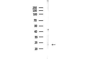 anti-Neurogenin 3 (NEUROG3) (N-Term) antibody