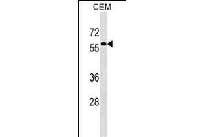 MSL3 Antibody (N-term) (ABIN1539253 and ABIN2849308) western blot analysis in CEM cell line lysates (35 μg/lane). (MSL3 抗体  (N-Term))