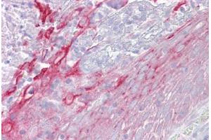 Anti-CFP / Properdin antibody IHC staining of human tonsil. (CFP 抗体  (AA 35-84))
