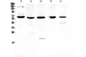 Western blot analysis of TRAF3 using anti-TRAF3 antibody . (TRAF3 抗体  (AA 298-551))