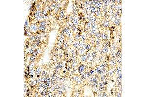 Immunohistochemistry (IHC) image for anti-Basigin (Ok Blood Group) (BSG) (AA 30-200) antibody (ABIN1512647)