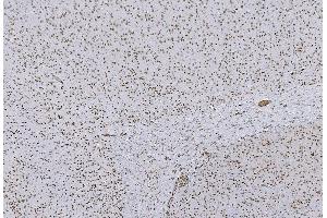 IHC analysis of HP1 alpha/CBX5 using anti-HP1 alpha/CBX5 antibody (ABIN7599057).