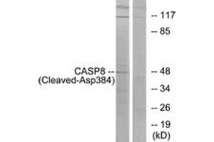 Western blot analysis of extracts from 293 cells, treated with etoposide 25uM 1h, using Caspase 8 (Cleaved-Asp384) Antibody. (Caspase 8 抗体  (Cleaved-Asp384))