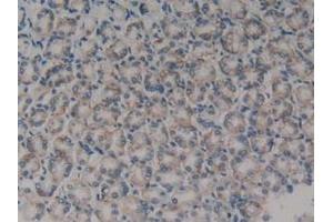 Detection of TLN1 in Rat Stomach Tissue using Polyclonal Antibody to Talin 1 (TLN1) (TLN1 抗体  (AA 975-1181))