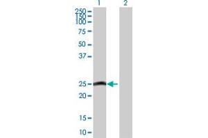 Western Blot analysis of MYL6B expression in transfected 293T cell line by MYL6B MaxPab polyclonal antibody. (MYL6B 抗体  (AA 1-208))