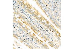 Immunohistochemistry (Paraffin-embedded Sections) (IHC (p)) image for anti-ATPase, Ca++ Transporting, Plasma Membrane 1 (ATP2B1) antibody (ABIN7073155)