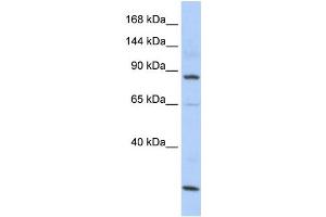 Western Blotting (WB) image for anti-MutS Homolog 5 (MSH5) antibody (ABIN2458577) (MSH5 抗体)