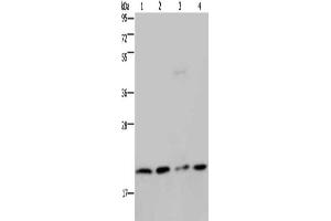 Gel: 10 % SDS-PAGE, Lysate: 40 μg, Lane 1-4: Jurkat cells, K562 cells, PC3 cells, A549 cells, Primary antibody: ABIN7130206(MCTS1 Antibody) at dilution 1/200, Secondary antibody: Goat anti rabbit IgG at 1/8000 dilution, Exposure time: 3 minutes (MCTS1 抗体)