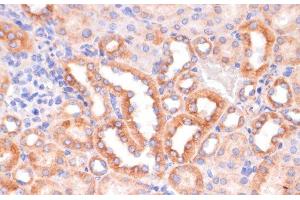 Immunohistochemistry of paraffin-embedded Mouse kidney using IKK alpha Polyclonal Antibody at dilution of 1:100 (40x lens). (IKK alpha 抗体)