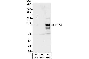 Western Blotting (WB) image for anti-PTK2B Protein tyrosine Kinase 2 beta (PTK2B) (AA 275-325) antibody (ABIN7449797)