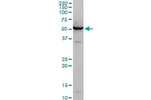 Western Blotting (WB) image for anti-Potassium Inwardly-Rectifying Channel, Subfamily J, Member 5 (KCNJ5) (AA 136-204) antibody (ABIN564116)