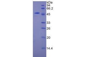 SDS-PAGE analysis of Mouse CPT1A Protein. (CPT1A 蛋白)