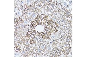 Immunohistochemistry of paraffin-embedded rat liver using [KO Validated] Glutamine Synthetase (Glutamine Synthetase (GLUL)) Rabbit pAb (ABIN6130425, ABIN6141161, ABIN6141162 and ABIN7101772) at dilution of 1:150 (40x lens). (GLUL 抗体  (AA 1-373))
