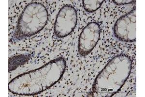 Image no. 3 for anti-High-Mobility Group 20A (HMG20A) (AA 153-263) antibody (ABIN599514) (HMG20A 抗体  (AA 153-263))