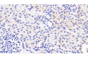 Detection of LAMa3 in Human Kidney Tissue using Polyclonal Antibody to Laminin Alpha 3 (LAMa3) (LAMA3 抗体  (AA 47-296))