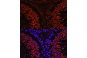Immunofluorescence (IF) image for anti-Sperm Adhesion Molecule 1 (PH-20 Hyaluronidase, Zona Pellucida Binding) (SPAM1) (AA 100-300) antibody (ABIN1513554)