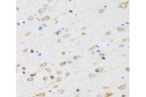 Immunohistochemistry of paraffin-embedded Rat brain using CHRM5 Polyclonal Antibody at dilution of 1:100 (40x lens). (CHRM5 抗体)
