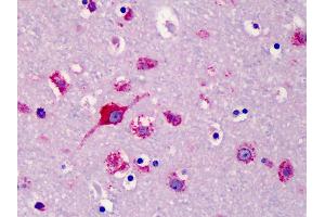 Anti-SLC35D1 antibody IHC of human brain, cortex. (SLC35D1 抗体  (N-Term))