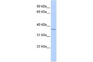 WB Suggested Anti-MTHFD2 Antibody Titration:  0. (MTHFD2 抗体  (N-Term))