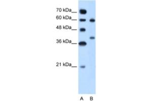 Western Blotting (WB) image for anti-Arginase, Liver (ARG1) antibody (ABIN2462876) (Liver Arginase 抗体)