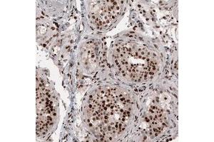 Immunohistochemical staining (Formalin-fixed paraffin-embedded sections) of human testis shows strong nuclear positivity in cells in seminiferous tubules. (METTL14 抗体)