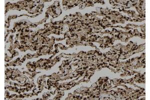 ABIN6273321 at 1/100 staining Human lung tissue by IHC-P. (SMYD3 抗体  (N-Term))
