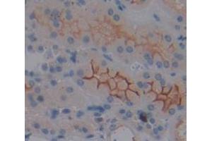 Used in DAB staining on fromalin fixed paraffin- embedded Kidney tissue (MT-ND1 抗体  (AA 19-84))