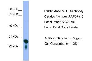 WB Suggested Anti-RAB5C  Antibody Titration: 0. (Rab5c 抗体  (Middle Region))